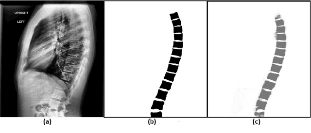 Figure 3 for Automated Segmentation of Vertebrae on Lateral Chest Radiography Using Deep Learning
