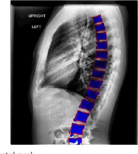 Figure 4 for Automated Segmentation of Vertebrae on Lateral Chest Radiography Using Deep Learning