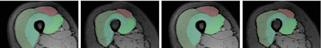 Figure 2 for Discriminative Parameter Estimation for Random Walks Segmentation