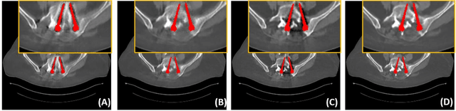 Figure 3 for DAN-Net: Dual-Domain Adaptive-Scaling Non-local Network for CT Metal Artifact Reduction