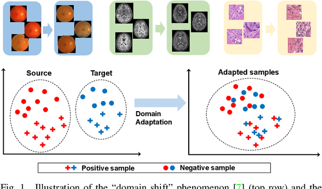 Figure 1 for DomainATM: Domain Adaptation Toolbox for Medical Data Analysis