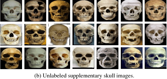 Figure 4 for On Matching Skulls to Digital Face Images: A Preliminary Approach