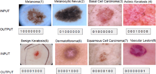 Figure 2 for Method to Classify Skin Lesions using Dermoscopic images