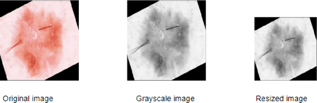 Figure 4 for Method to Classify Skin Lesions using Dermoscopic images