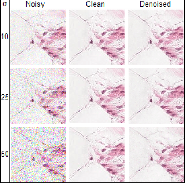 Figure 4 for Blind microscopy image denoising with a deep residual and multiscale encoder/decoder network