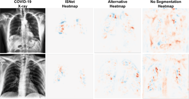 Figure 2 for ISNet: Costless and Implicit Image Segmentation for Deep Classifiers, with Application in COVID-19 Detection