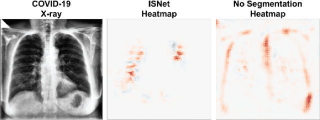 Figure 4 for ISNet: Costless and Implicit Image Segmentation for Deep Classifiers, with Application in COVID-19 Detection