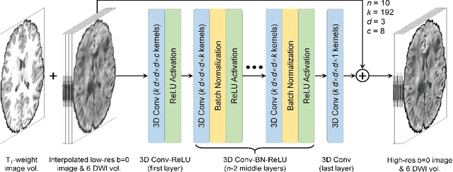 Figure 1 for SRDTI: Deep learning-based super-resolution for diffusion tensor MRI