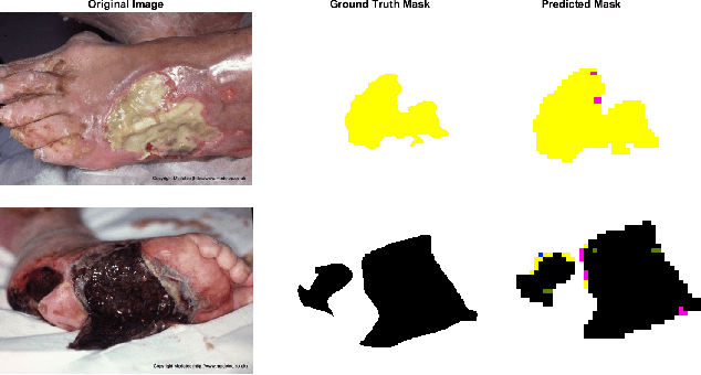 Figure 4 for Fine-grained wound tissue analysis using deep neural network