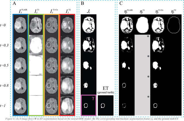 Figure 4 for A Neural Ordinary Differential Equation Model for Visualizing Deep Neural Network Behaviors in Multi-Parametric MRI based Glioma Segmentation