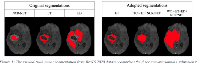 Figure 1 for A Neural Ordinary Differential Equation Model for Visualizing Deep Neural Network Behaviors in Multi-Parametric MRI based Glioma Segmentation