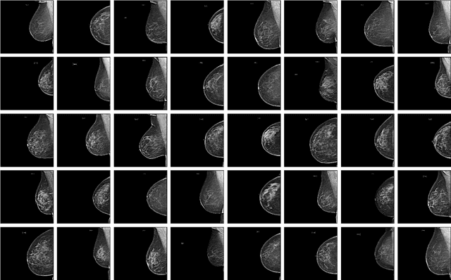 Figure 1 for MammoGANesis: Controlled Generation of High-Resolution Mammograms for Radiology Education