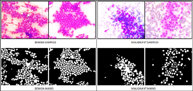 Figure 3 for SynCGAN: Using learnable class specific priors to generate synthetic data for improving classifier performance on cytological images