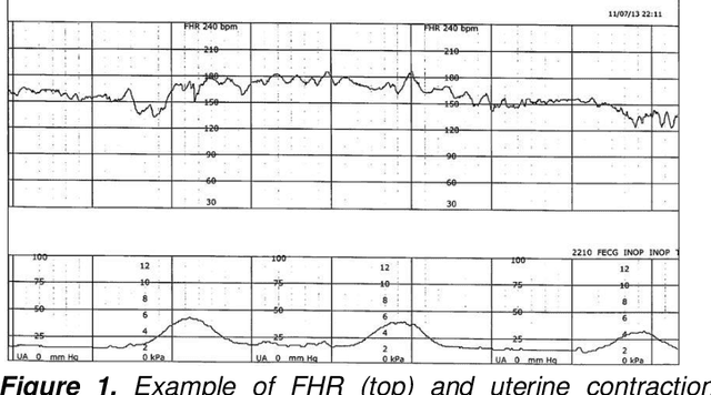 Figure 1 for Detection of preventable fetal distress during labor from scanned cardiotocogram tracings using deep learning