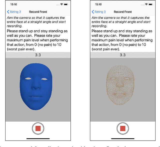 Figure 1 for Pain Intensity Estimation from Mobile Video Using 2D and 3D Facial Keypoints