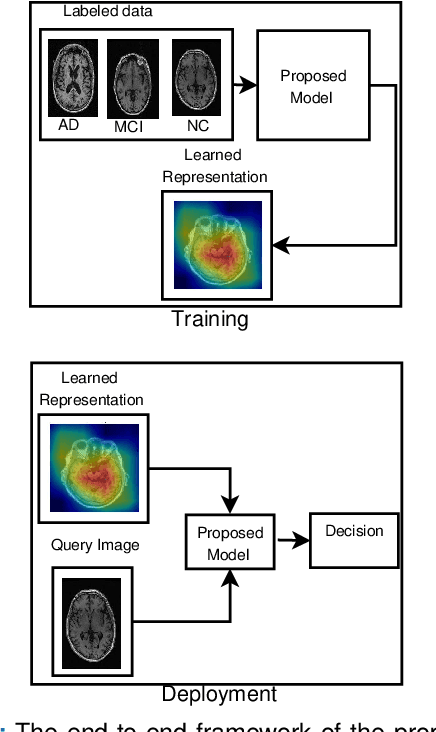 Figure 1 for Transfer Learning with intelligent training data selection for prediction of Alzheimer's Disease