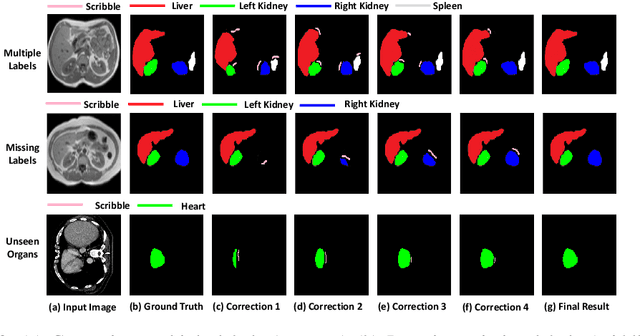 Figure 4 for Efficient and Generic Interactive Segmentation Framework to Correct Mispredictions during Clinical Evaluation of Medical Images
