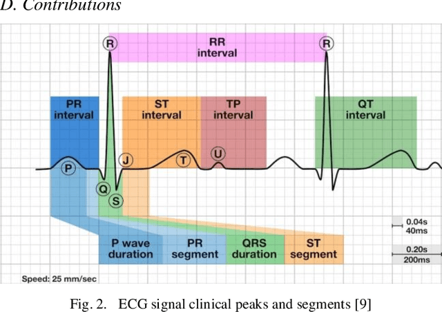 Figure 2 for Core-set Selection Using Metrics-based Explanations (CSUME) for multiclass ECG