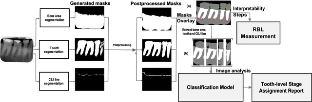 Figure 1 for An End-to-end Entangled Segmentation and Classification Convolutional Neural Network for Periodontitis Stage Grading from Periapical Radiographic Images
