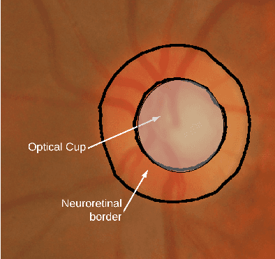 Figure 3 for A Study on the Use of Edge TPUs for Eye Fundus Image Segmentation