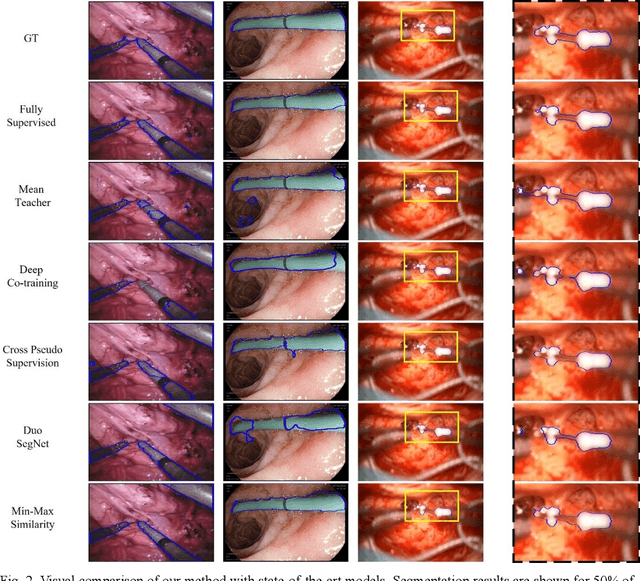 Figure 4 for Min-Max Similarity: A Contrastive Learning Based Semi-Supervised Learning Network for Surgical Tools Segmentation