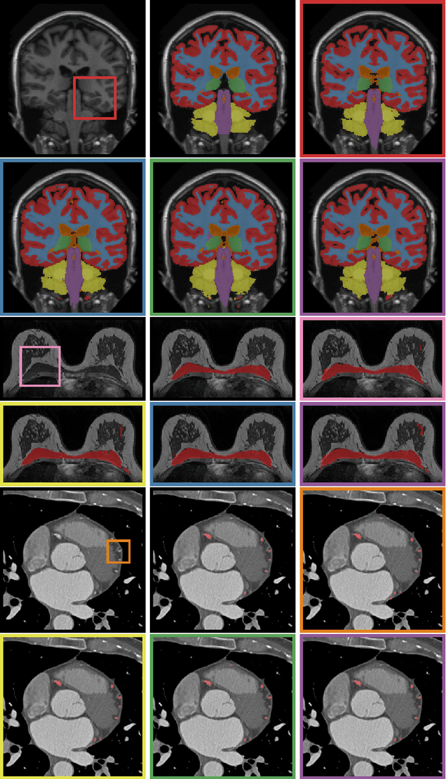 Figure 3 for Deep Learning for Multi-Task Medical Image Segmentation in Multiple Modalities