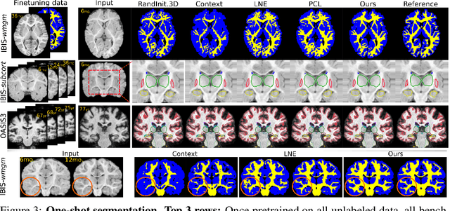 Figure 4 for Local Spatiotemporal Representation Learning for Longitudinally-consistent Neuroimage Analysis