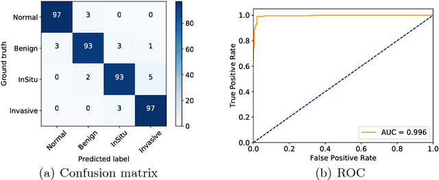 Figure 3 for Improving High Resolution Histology Image Classification with Deep Spatial Fusion Network