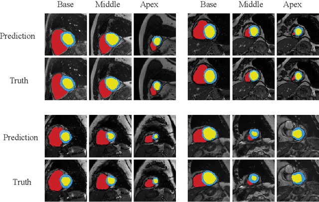 Figure 4 for RT-DNAS: Real-time Constrained Differentiable Neural Architecture Search for 3D Cardiac Cine MRI Segmentation