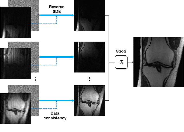 Figure 3 for Score-based diffusion models for accelerated MRI