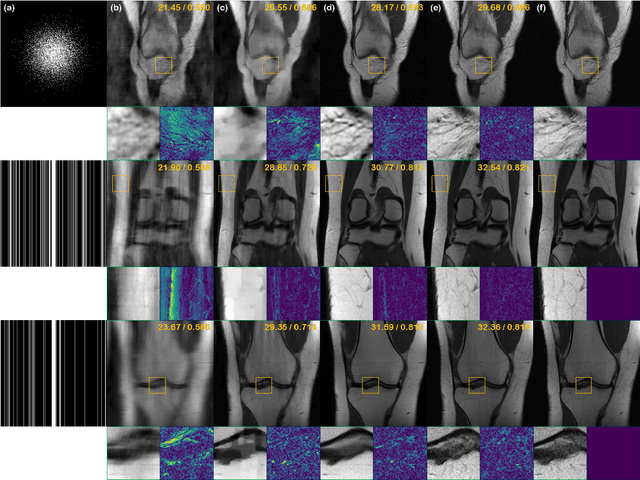 Figure 4 for Score-based diffusion models for accelerated MRI