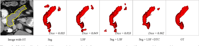 Figure 3 for Semi-supervised Medical Image Segmentation through Dual-task Consistency