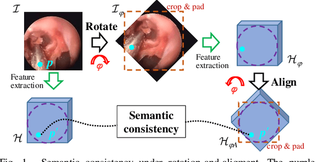 Figure 1 for Towards Better Surgical Instrument Segmentation in Endoscopic Vision: Multi-Angle Feature Aggregation and Contour Supervision