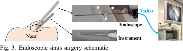 Figure 3 for Towards Better Surgical Instrument Segmentation in Endoscopic Vision: Multi-Angle Feature Aggregation and Contour Supervision
