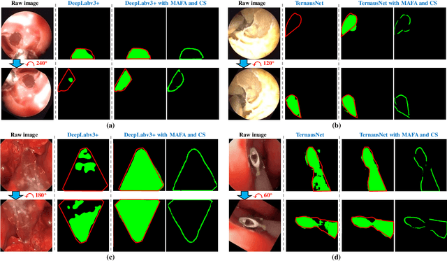 Figure 4 for Towards Better Surgical Instrument Segmentation in Endoscopic Vision: Multi-Angle Feature Aggregation and Contour Supervision