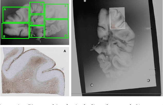 Figure 1 for Part-to-whole Registration of Histology and MRI using Shape Elements