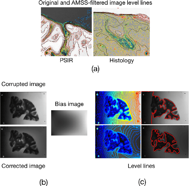 Figure 2 for Part-to-whole Registration of Histology and MRI using Shape Elements