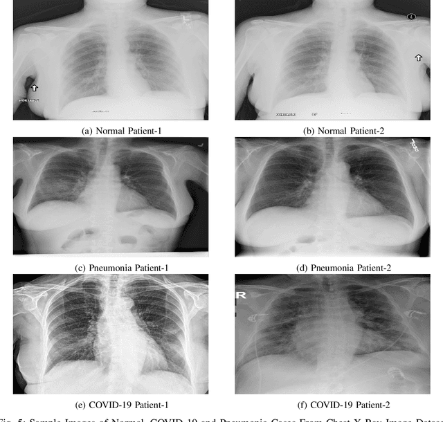 Figure 4 for Fuzzy Unique Image Transformation: Defense Against Adversarial Attacks On Deep COVID-19 Models