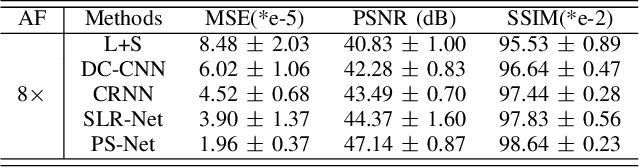 Figure 4 for PS-Net: Deep Partially Separable Modelling for Dynamic Magnetic Resonance Imaging