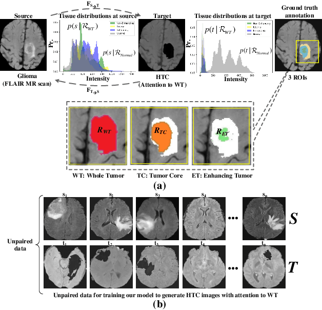 Figure 1 for High Tissue Contrast MRI Synthesis Using Multi-Stage Attention-GAN for Glioma Segmentation