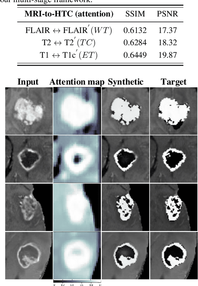 Figure 4 for High Tissue Contrast MRI Synthesis Using Multi-Stage Attention-GAN for Glioma Segmentation