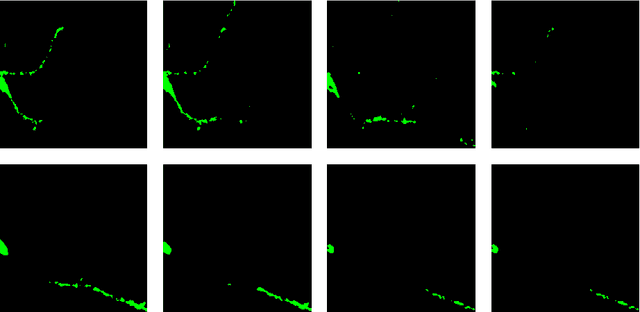 Figure 3 for Neuron detection in stack images: a persistent homology interpretation