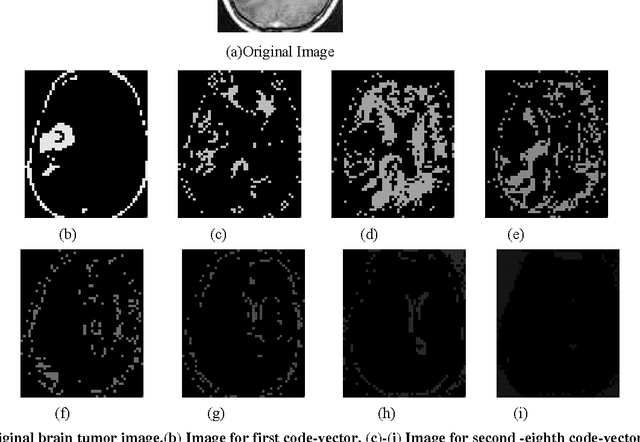 Figure 1 for Detection and Demarcation of Tumor using Vector Quantization in MRI images