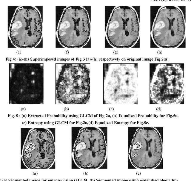 Figure 2 for Detection and Demarcation of Tumor using Vector Quantization in MRI images