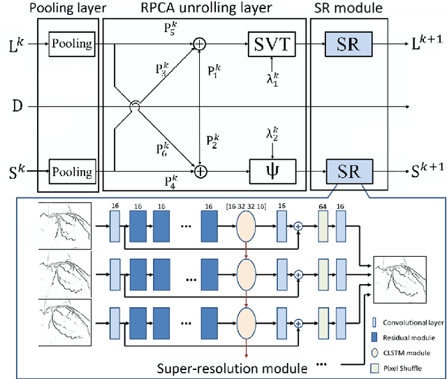 Figure 1 for Robust PCA Unrolling Network for Super-resolution Vessel Extraction in X-ray Coronary Angiography