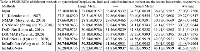 Figure 2 for InDuDoNet+: A Model-Driven Interpretable Dual Domain Network for Metal Artifact Reduction in CT Images