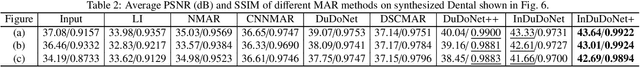 Figure 4 for InDuDoNet+: A Model-Driven Interpretable Dual Domain Network for Metal Artifact Reduction in CT Images