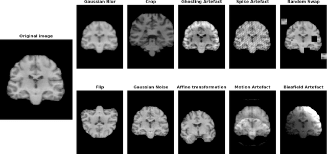 Figure 4 for Benchmarking CNN on 3D Anatomical Brain MRI: Architectures, Data Augmentation and Deep Ensemble Learning