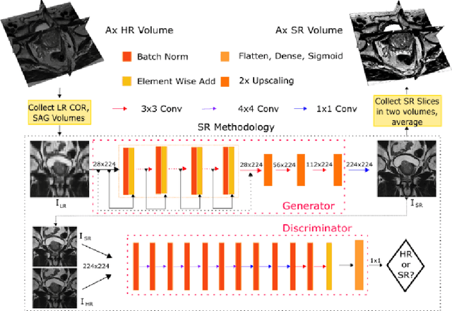 Figure 1 for Anisotropic Super Resolution in Prostate MRI using Super Resolution Generative Adversarial Networks