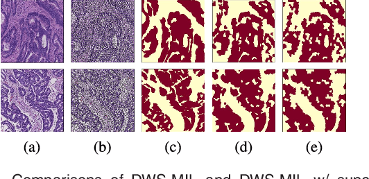 Figure 2 for Constrained Deep Weak Supervision for Histopathology Image Segmentation